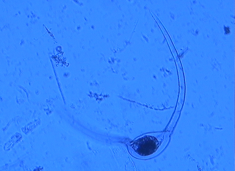 Dictyocha speculum